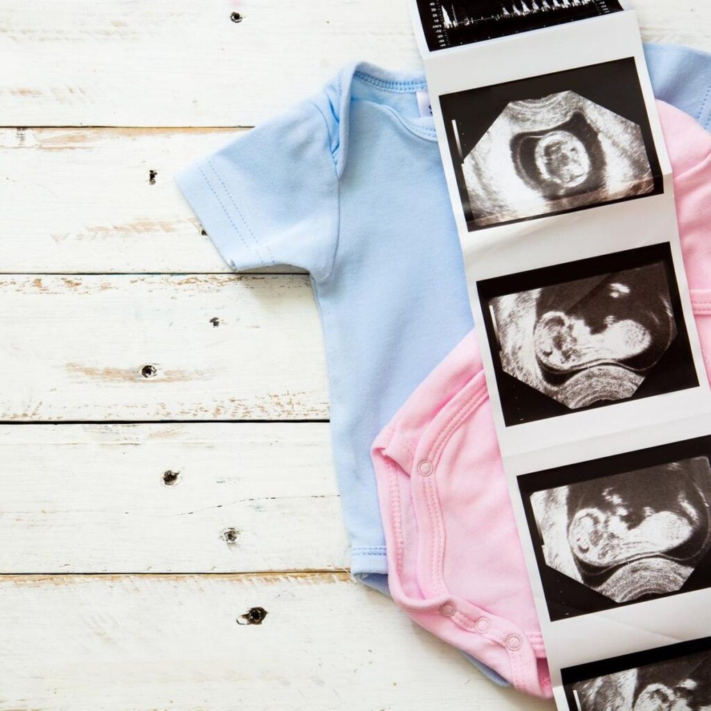 Penyebab Hasil USG Kelamin Bayi Berbeda Saat Lahir