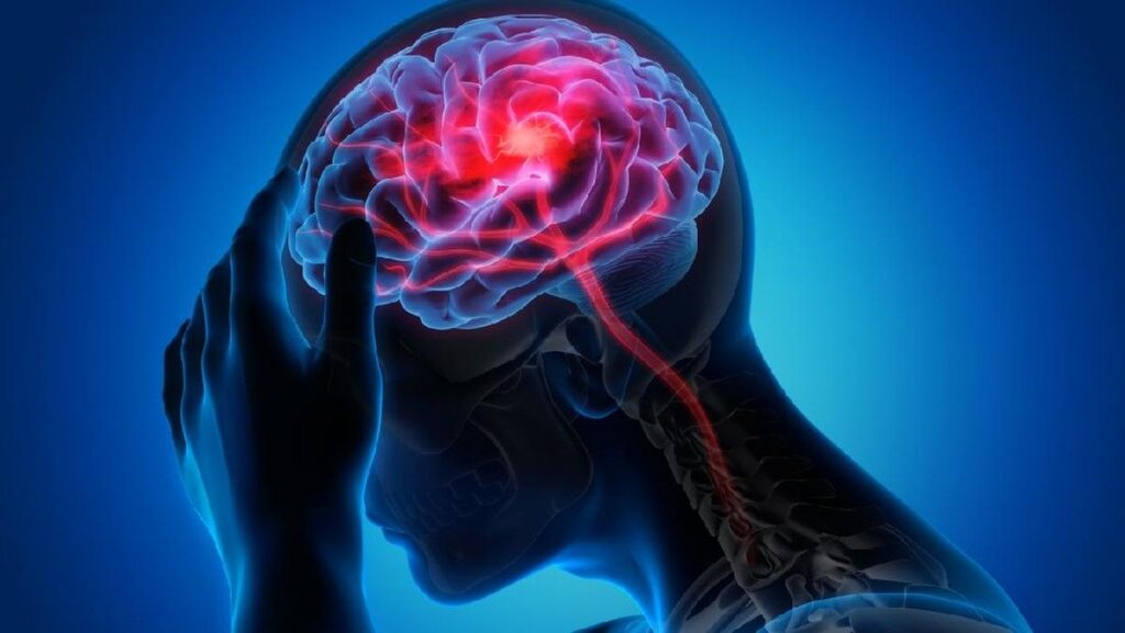 Gangguan Tidur Mengintai Anak Muda Jadi Pemicu Stroke Tersembunyi