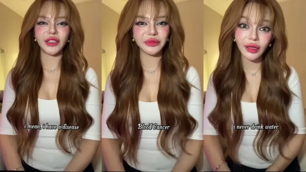 Influencer Asal Vietnam An Thy Didiagnosis Mengidap Leukemia