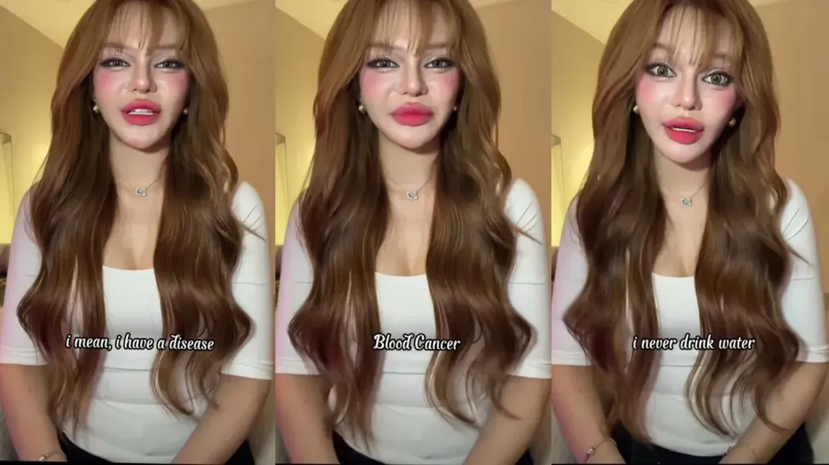 Influencer Asal Vietnam An Thy Didiagnosis Mengidap Leukemia