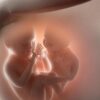 Mengenal Risiko Discordant Twin Growth pada Kehamilan Kembar