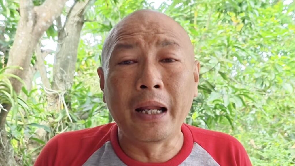 Mata Heru Gundul Terkena Semburan Bisa Ular Kobra saat Evakuasi