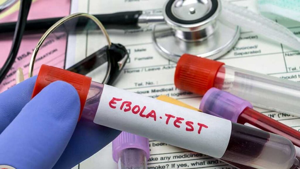 Kasus Ebola di Kongo Melonjak Menjadi 260 Pasien