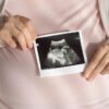 Dokter Gunakan Botox untuk Selamatkan Janin Gastroschisis Kompleks dalam Kandungan