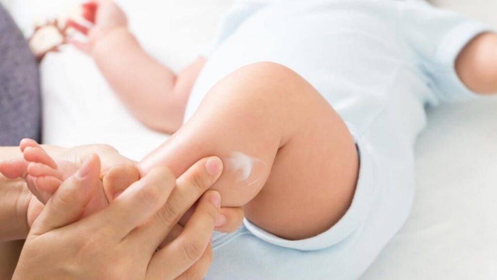 Dokter Anak Ingatkan Aturan Pakai Salep Hydrocortisone untuk Bayi