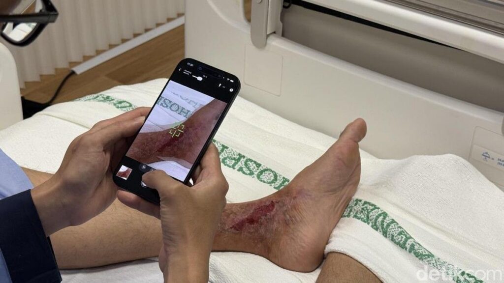 Bukan Cuma Apple Watch, iPhone dan iPad Ubah Layanan Medis Singapura