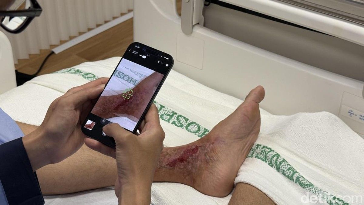 Bukan Cuma Apple Watch, iPhone dan iPad Ubah Layanan Medis Singapura