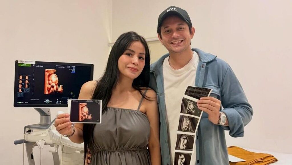 Andrew Andika Bagikan Kondisi Kehamilan Violentina Kaif yang Menginjak Lima Bulan