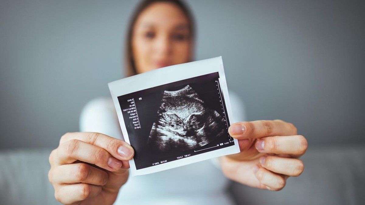 Ibu di Amerika Serikat Lahirkan Bayi Pengidap Sindrom Goldenhar