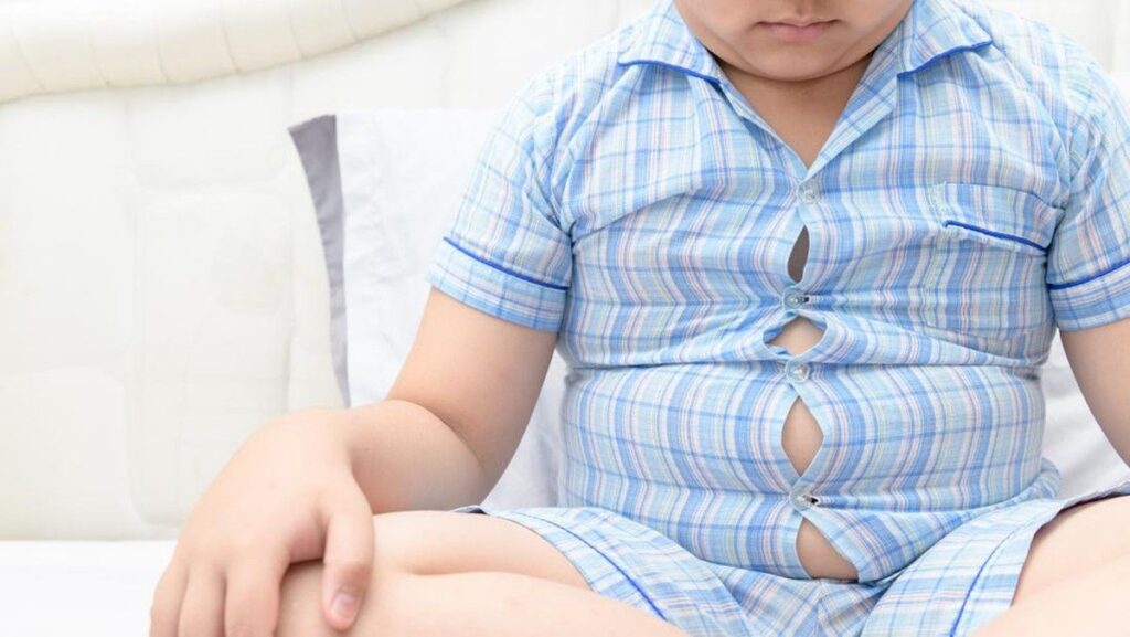 Dokter Anak Luruskan Salah Kaprah Penghentian Susu pada Anak Obesitas