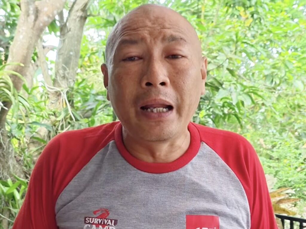 Heru Gundul Alami Kebutaan Sementara Usai Terkena Semburan Bisa Kobra