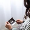 Pengadilan New York Menangkan Hak Embrio IVF Mantan Istri