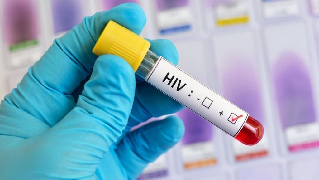 Dinkes Kabupaten Tangerang Temukan 203 Kasus HIV Baru