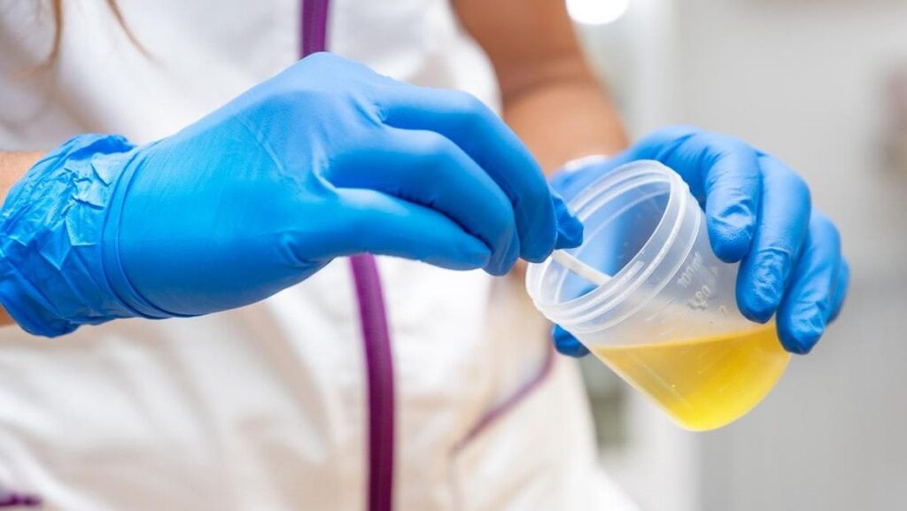 Ketahui Warna Urine yang Menandakan Kerusakan Fungsi Ginjal