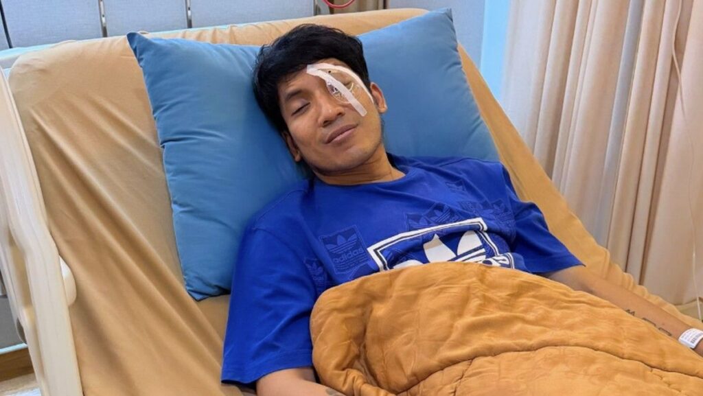 Desta Jalani Operasi Penyedotan Darah Setelah Cedera Mata Saat Main Padel