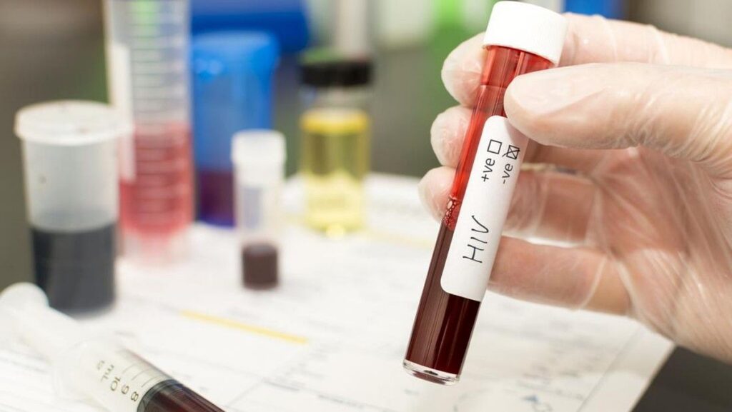 Kemenkes Lakukan Klarifikasi dan Clarify Data Kasus HIV Sidoarjo