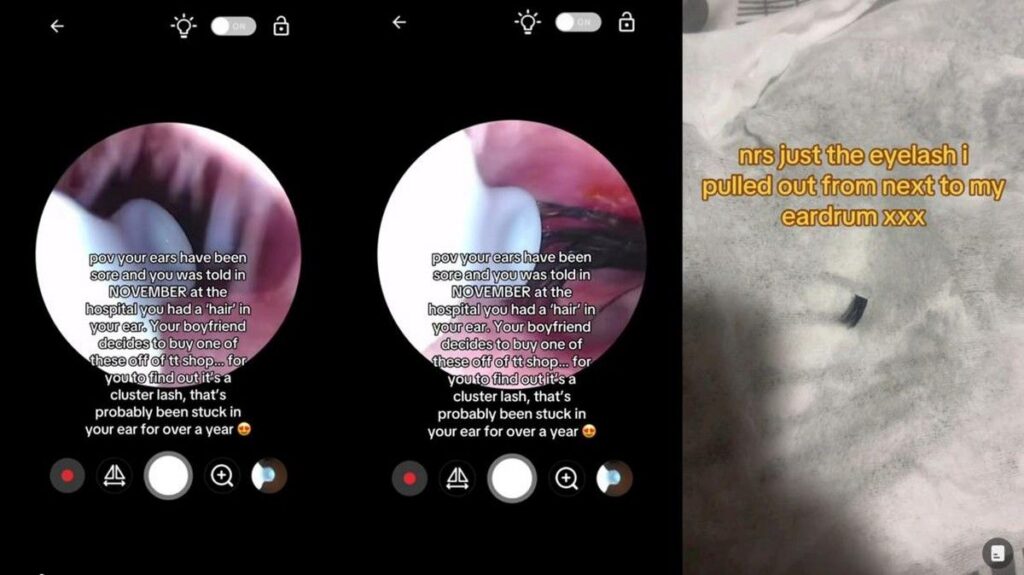 Bulu Mata Palsu Tersangkut di Telinga Wanita Ini Picu Sakit Kepala