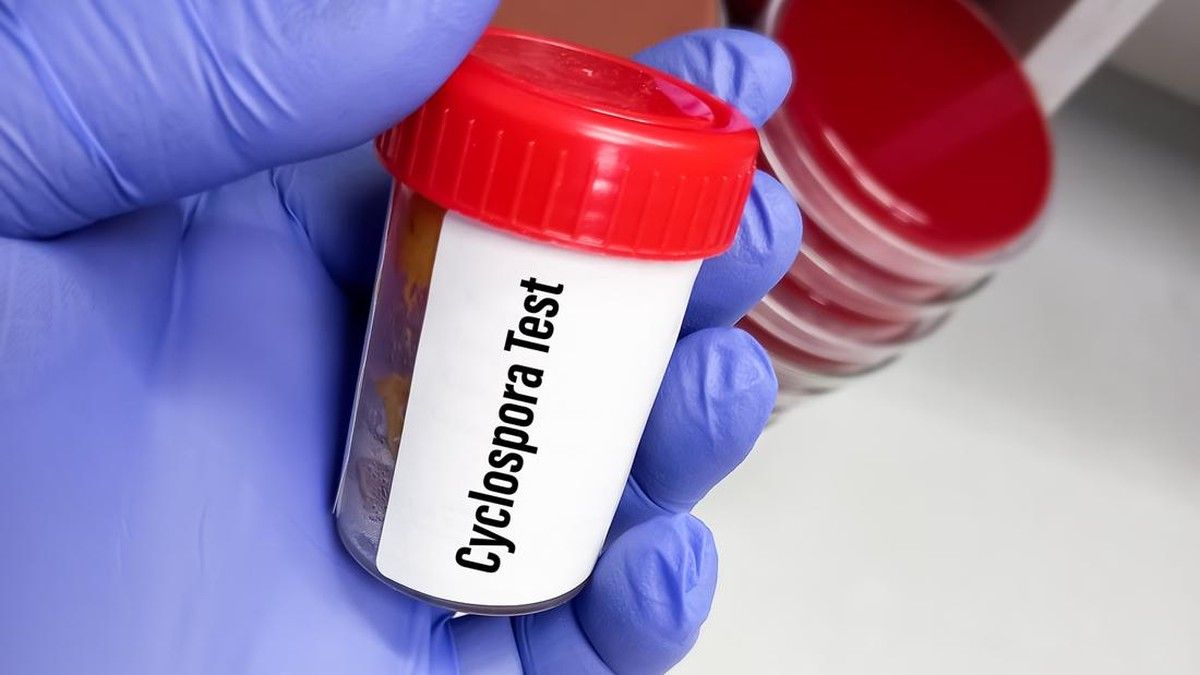 CDC melaporkan lonjakan kasus cyclosporiasis nasional
