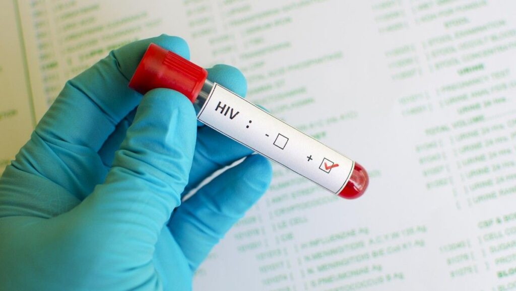 Kemenkes Luruskan Isu Kasus HIV Sidoarjo Bukan Penularan Baru