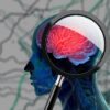 Diet Antiinflamasi Berpotensi Turunkan Risiko Demensia