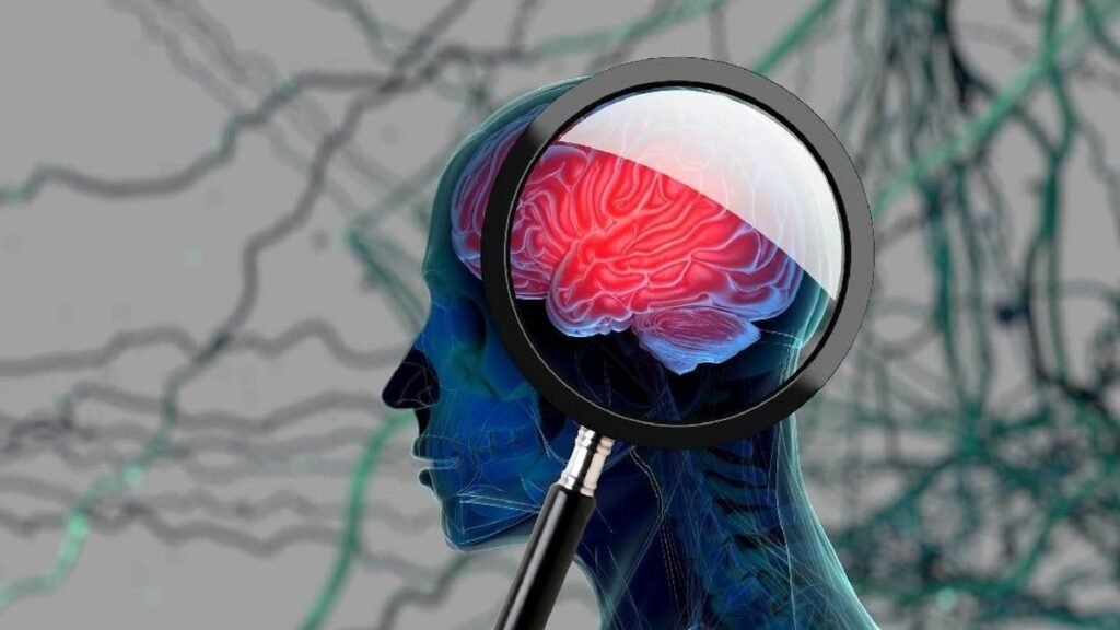 Diet Antiinflamasi Berpotensi Turunkan Risiko Demensia