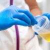 Urine Terlalu Jernih Bisa Menandakan Gangguan Fungsi Ginjal