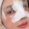 Elly Sugigi Rencanakan Operasi Gigi dan Facelift di Jakarta