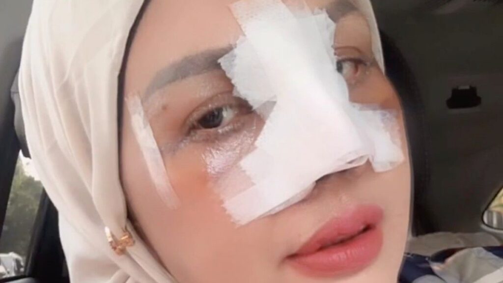 Elly Sugigi Rencanakan Operasi Gigi dan Facelift di Jakarta