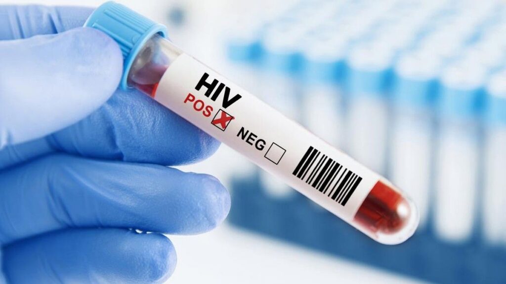 Kemenkes Klarifikasi Data HIV di Sidoarjo dan Tekankan Pentingnya Deteksi Dini