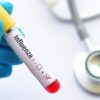 Hong Kong Alami Musim Flu dan Lonjakan Kasus COVID-19