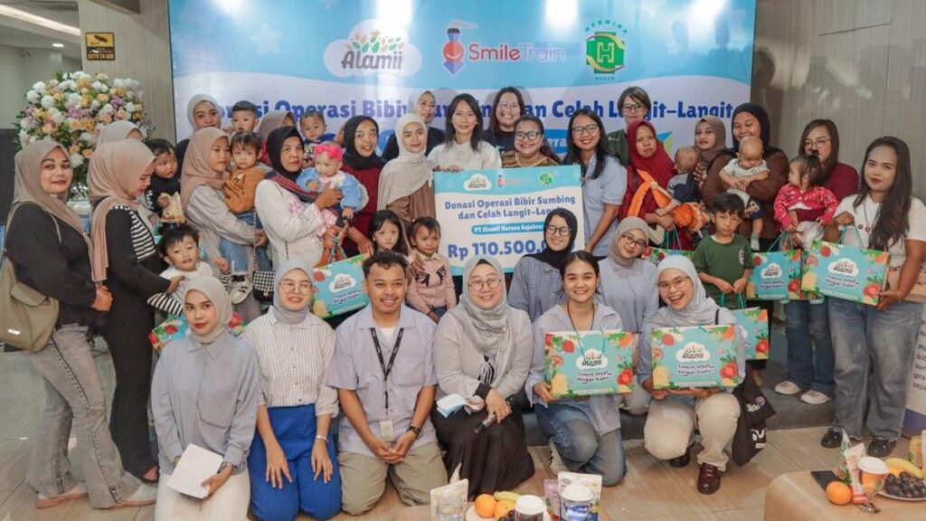 Smile Train dan Alamii Fasilitasi Operasi Bibir Sumbing 17 Anak
