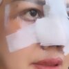 Elly Sugigi Jalani Operasi Plastik Hidung dan Mata Senilai Rp85 Juta