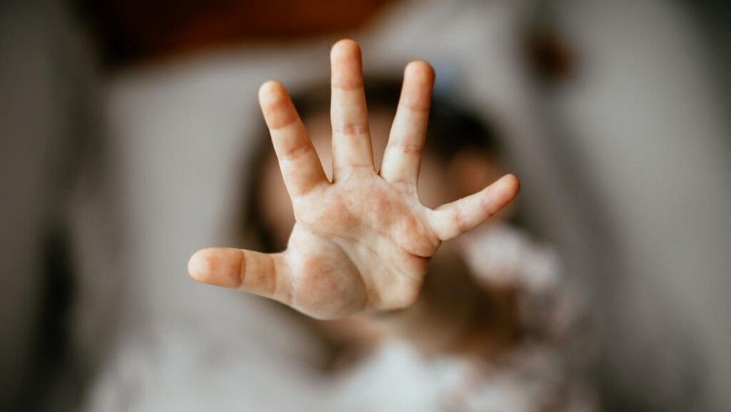 Polisi Selidiki Dugaan Pelecehan Verbal Anak di Bogor