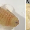 Larva Lalat Parasit Ditemukan Bersarang dalam Sinus Wanita Yunani