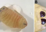 Larva Lalat Parasit Ditemukan Bersarang dalam Sinus Wanita Yunani