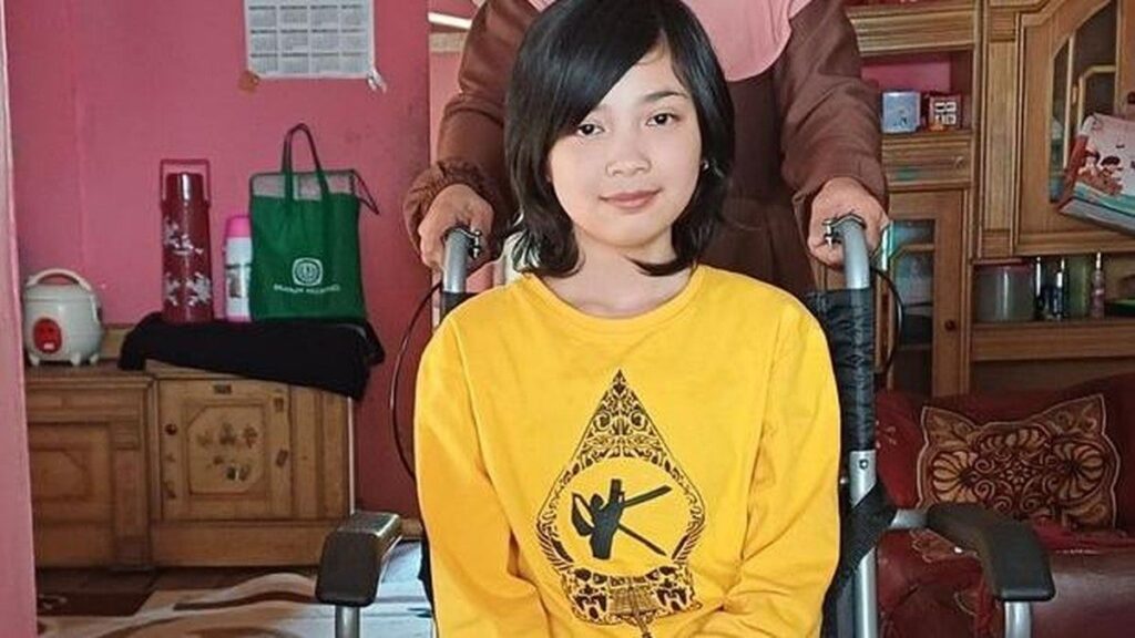 Remaja 14 Tahun di Bandung Amputasi Kaki Usai Jatuh