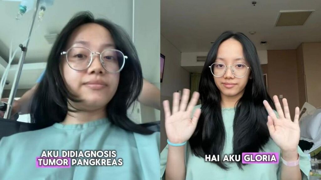 Perempuan Palangkaraya Idap Tumor Pankreas Usai Dikira Maag