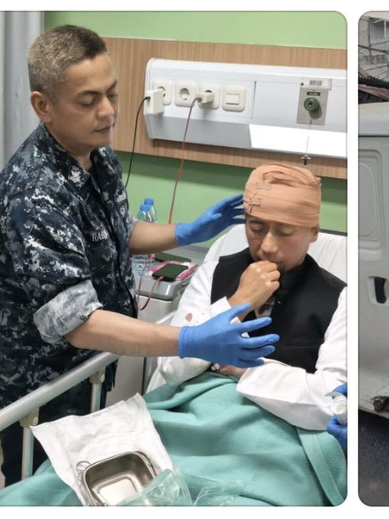 Vokalis PAS Band Yukie Alami Kecelakaan Mobil dan Jalani Operasi Kepala