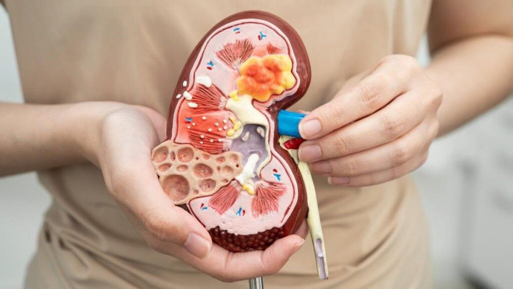 Dokter Gizi Ingatkan Bahaya Konsumsi Garam Berlebih Pemicu Stroke