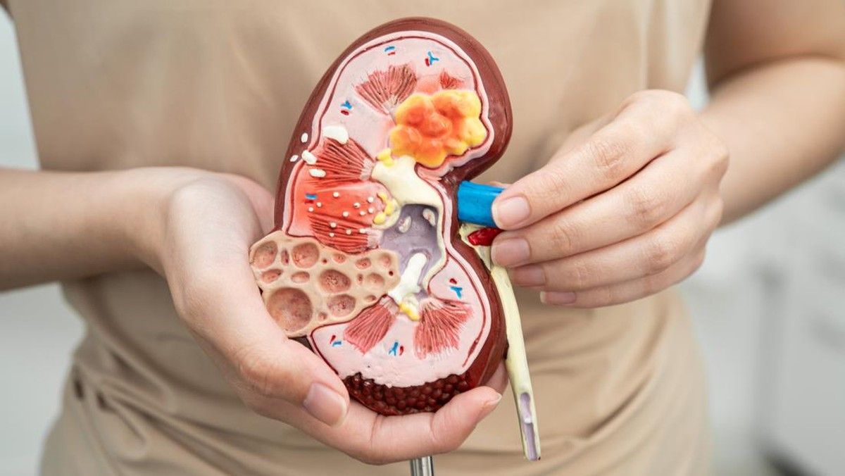 Dokter Gizi Ingatkan Bahaya Konsumsi Garam Berlebih Pemicu Stroke