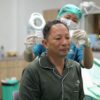 Ringgo Agus Rahman Jalani Transplantasi Rambut Tahap Kedua