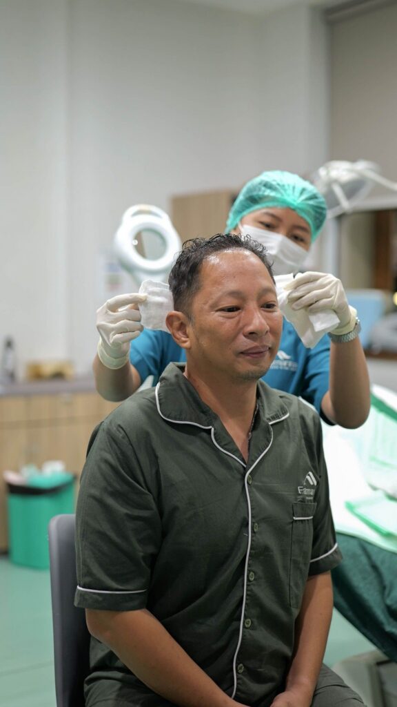 Ringgo Agus Rahman Jalani Transplantasi Rambut Tahap Kedua