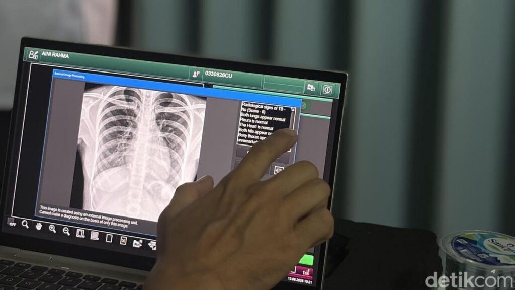 Menkes Perluas Skrining Tuberkulosis Gratis di Ponpes Jakarta Utara