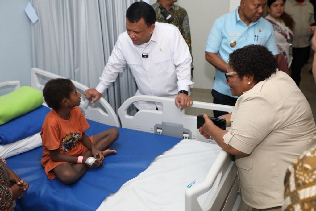 Wamendagri Tinjau Penanganan Korban Dugaan Keracunan MBG di Jayapura