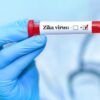 Pemerintah Bali Pastikan Belum Ada Kasus Virus Zika di Wilayahnya