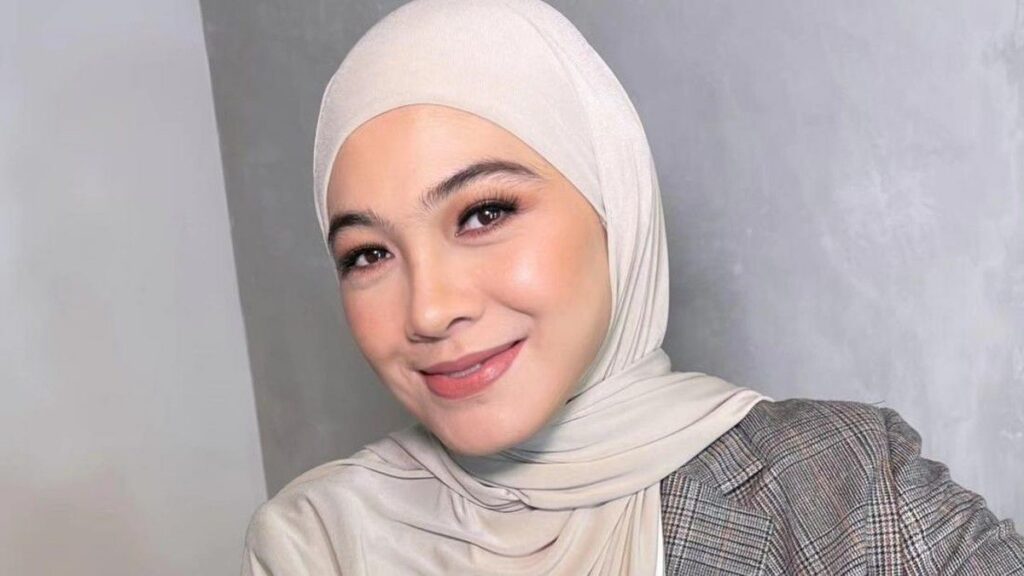Dian Ayu Lestari Alami Saraf Kejepit dan Dirawat di UGD