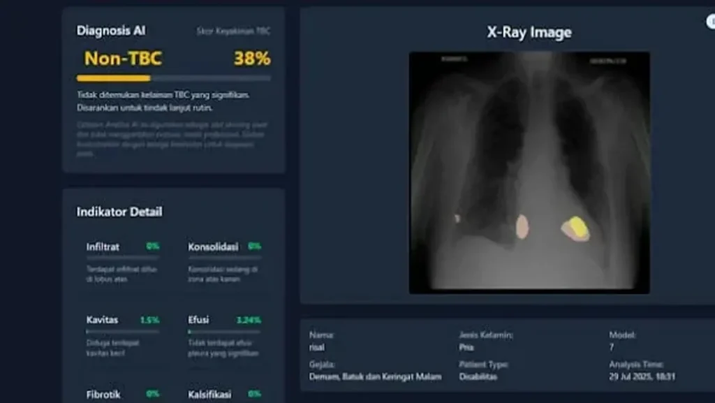 Tim UGM Kembangkan Sistem AI TBScreen.AI untuk Skrining Tuberkulosis