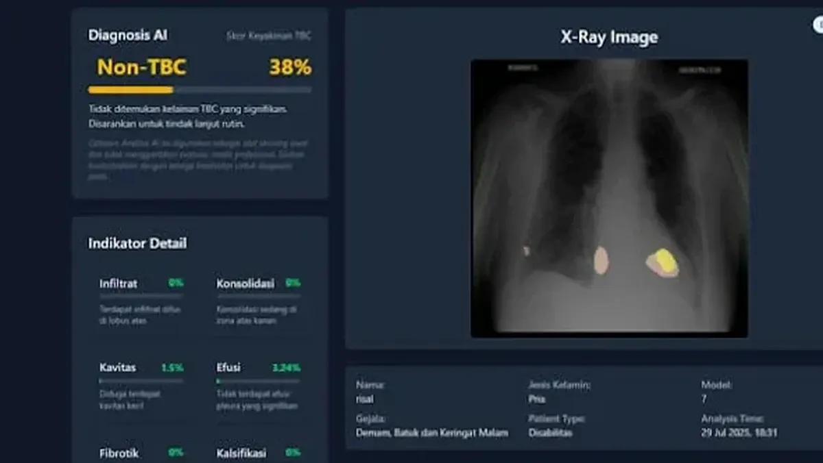Tim UGM Kembangkan Sistem AI TBScreen.AI untuk Skrining Tuberkulosis